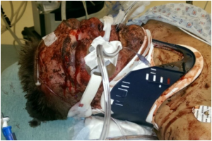  Russell Erickson Right After the Attack